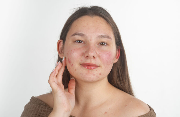 problème visage